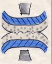 Schematische Darstellung Peelfolie